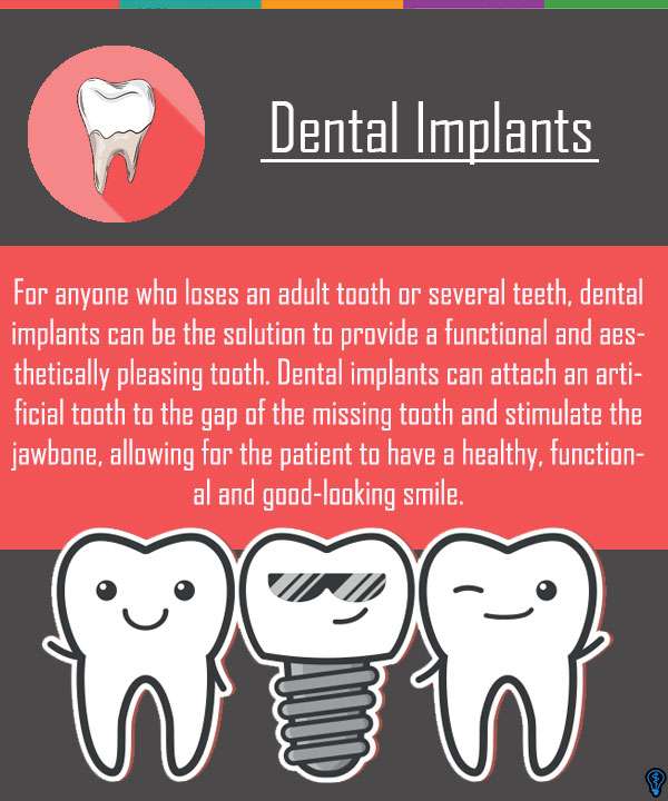 Dental Implants Swampscott, MA