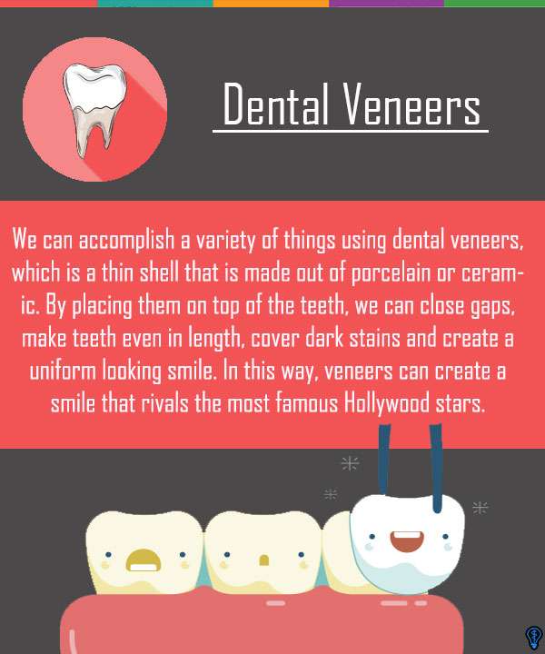 Effective Smile Enhancement With Dental Veneers