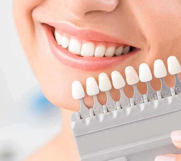 Swampscott Dental Veneers and Dental Laminates