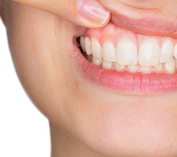 Swampscott Gum Disease