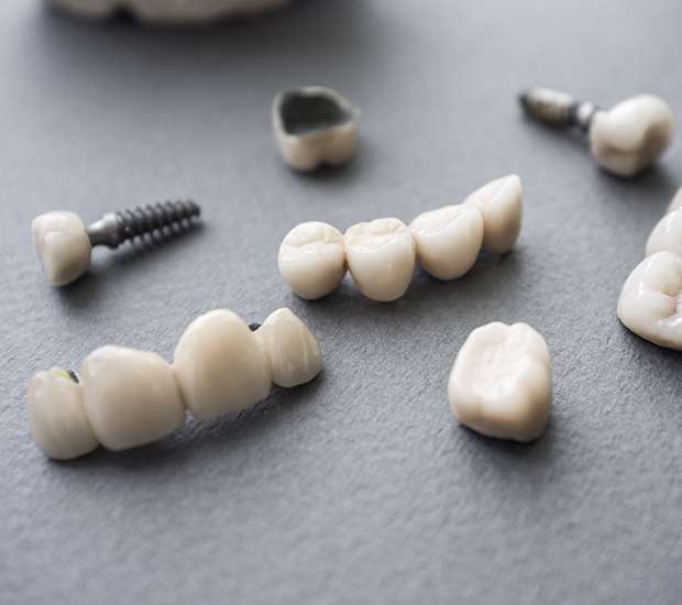 Swampscott The Difference Between Dental Implants and Mini Dental Implants