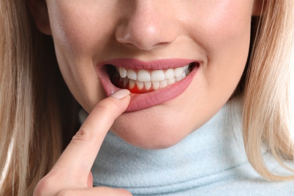 How Is Laser Dentistry Used To Treat Gum Disease?